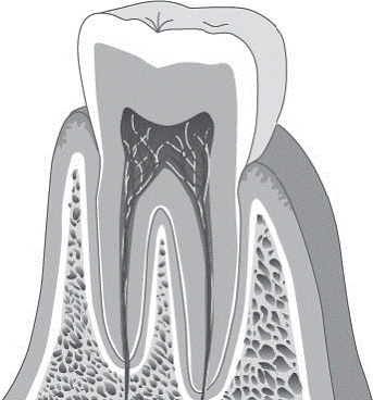 「歯の根 site:http://www.8181118.com/」の画像検索結果