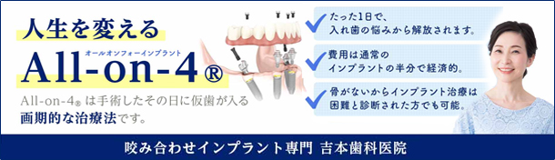 人生を変えるAll-on-4&reg;（オールオンフォーインプラント） All-on-4&reg;は手術したその日に仮歯が入る画期的な治療法です。[たった1日で、入れ歯の悩みから解放されます。] [費用は通常のインプラントの半分で経済的。] [骨がないからインプラント治療は困難と診断された方でも可能。]