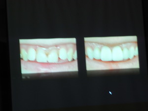 RIMG0442.JPGのサムネール画像