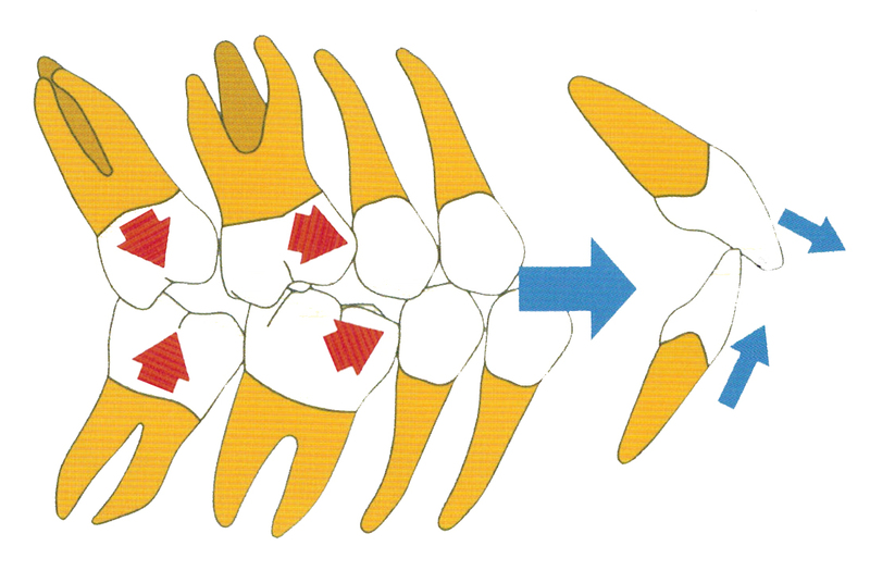 taoreru.jpgのサムネール画像