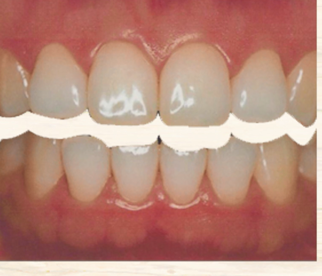 歯科治療成功の鍵は噛み合わせ｜咬み合わせ専門歯科　吉本歯科医院