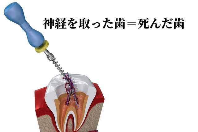 歯科の保険治療と保険外治療の違い｜香川県高松市の咬み合わせ専門　吉本歯科医院