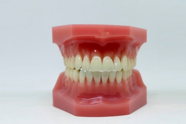 重度歯周病・ひどい歯瘻膿漏の原因と治療法｜香川県高松市の咬み合わせ専門　吉本歯科医院