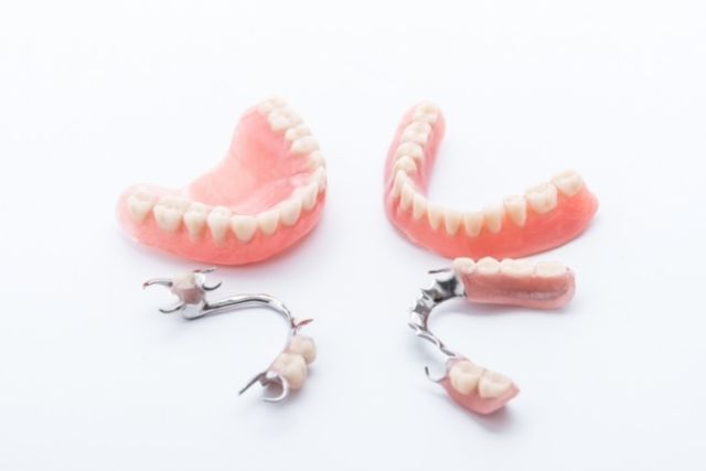 歯を抜いた後の治療法｜入れ歯かインプラントか？｜噛み合わせ専門の吉本歯科医院