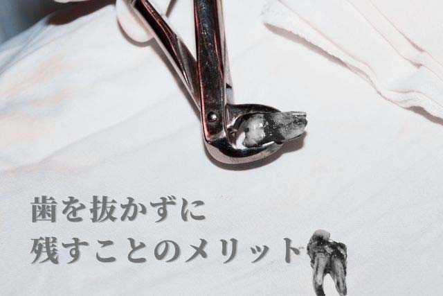 歯を抜かずに残すメリットを解説｜香川県高松市の咬み合わせ専門の吉本歯科医院