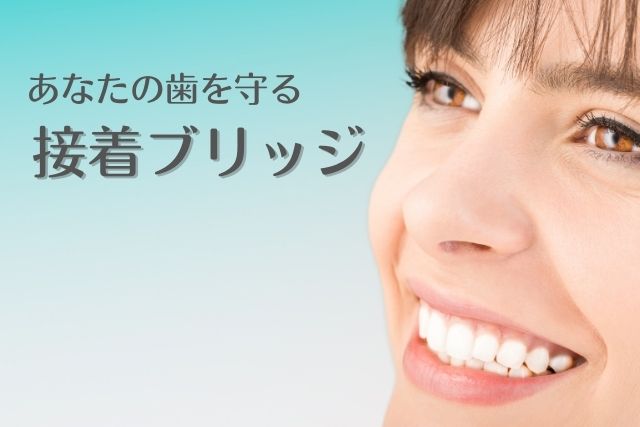 歯を削らずにすむ接着ブリッジは香川県高松市の咬み合わせ専門　吉本歯科医院