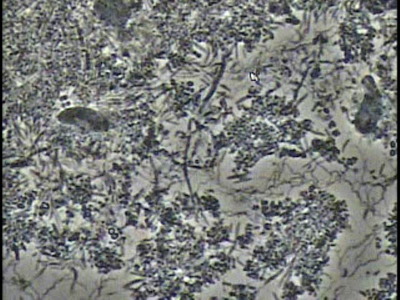 歯の神経のお痛みなら香川県高松市の歯の神経治療専門歯科 吉本歯科医院