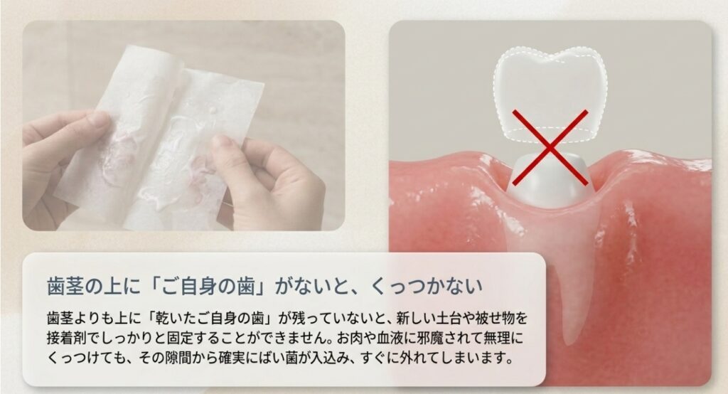 歯を抜きたい人はいない〜それでも知っておくべき「抜歯が必要な4つの状態」|咬み合わせ専門の吉本歯科医院【香川県高松市】