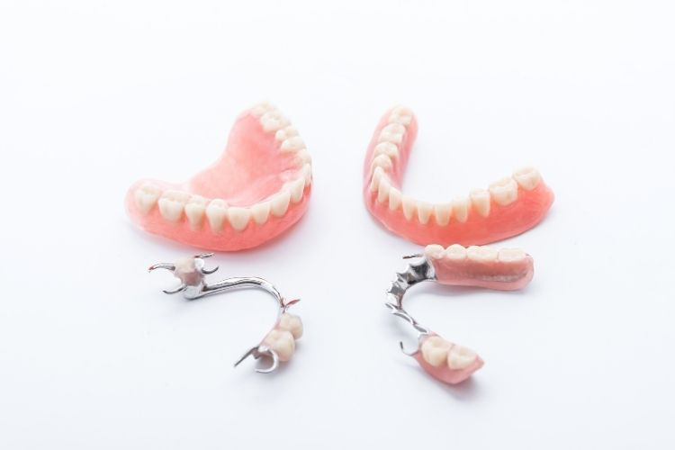 入れ歯のように 自分で装置を外したり 毎回装置を洗浄しなくてもいいから、です。 脱着式の入れ歯を使うという精神的老化を認めなくてすむから、です。