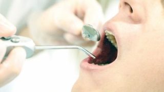 歯根破折と診断された歯の治療は？