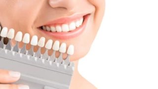 セラミックは変色しないのでしょうか？【審美歯科のご相談】