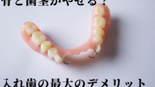 入れ歯の最大のデメリットを知っていますか？