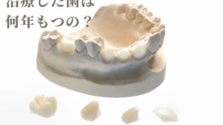 治療した歯の寿命は？何年もちますか？