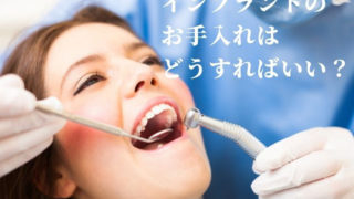 インプラントのお手入れはどうすればいい？