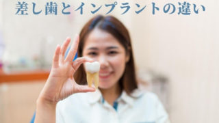 差し歯とインプラントの違い