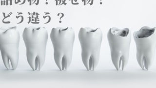 詰め物と被せ物は何が違うんですか？
