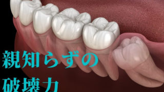 親知らずの破壊力