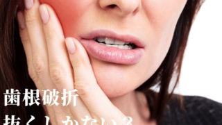 歯根破折！抜くしかない？
