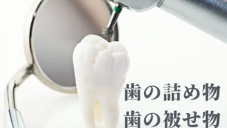 歯の詰め物か被せ物、どう違う？