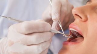インプラントのトラブルは治療後2年以内に起こることが9割
