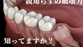 奥歯が割れた原因は親知らずでした