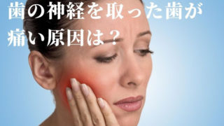歯の神経を抜いたはずの歯がずっと痛む原因は？