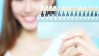 歯を白くする方法ラミネートべニア