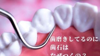 歯磨きしているのに歯石がつくのはなぜ？
