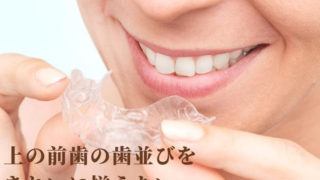 前歯のガタガタになっている歯並びをきれいにしたい【マウスピース矯正】