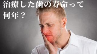 治療した歯は一生もちますか？歯科治療した歯の寿命は？