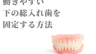 動きやすい下の総入れ歯を固定する方法