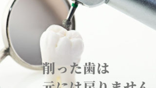 一度削り取った歯は元には戻りません。