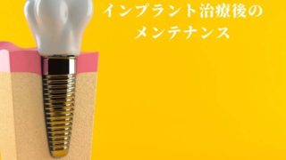 インプラント治療後のメインテナンスは必須です。