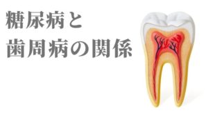 歯周病と糖尿病の密な関係