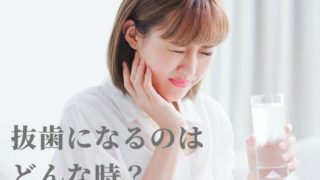 歯を抜かないといけないと診断を受けた方へ