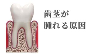 歯茎が腫れる７つの原因