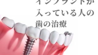1本でもインプラントを入れている方の歯の治療