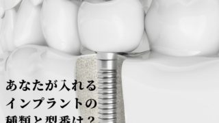 あなたが入れるインプラントの種類と型番は何ですか？