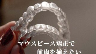 上の前歯がガタガタしているのをまっすぐに揃えたい【マウスピース矯正】