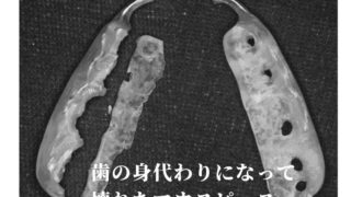 マウスピースはあなたの歯の身代わりになって割れてくれます