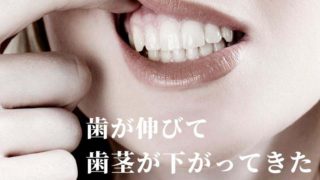 歯が伸びて歯茎が下がってきた