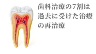何度も同じ部分の虫歯が再発する理由