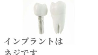 インプラントは自分の歯のように自覚症状がありません。