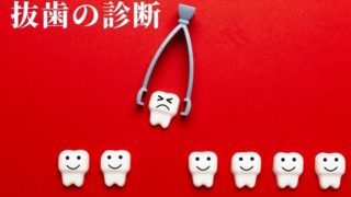 抜歯の診断方法