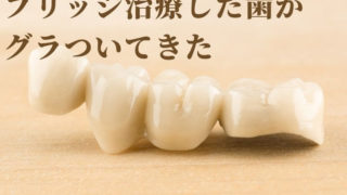 ブリッジでつなぐ治療をした部分がグラグラして噛めない