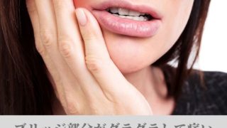 過去にブリッジ治療した部分が痛くて外したが・・・。