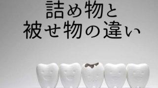 歯の詰め物、歯の被せ物の違い