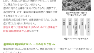 歯のメインテナンスの違いがあなたの人生を変える