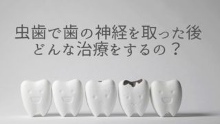 虫歯で歯の神経を取った後にするのはどんな治療ですか？
