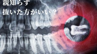 最近、前歯がすごぐ出てきた気がする